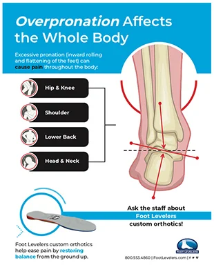 Chiropractic Greenville SC Overpronation Affects the Whole Body Poster